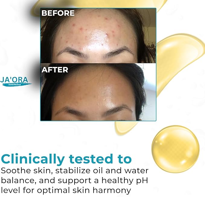 Clarifying Face Toner – Calendula Extract, Azelaic Acid & Ivy Leaf for Balanced, Hydrated & Revitalized Skin | Alcohol-Free, Unscented Toner for All Skin Types (200ML / 6.76 FL.OZ)