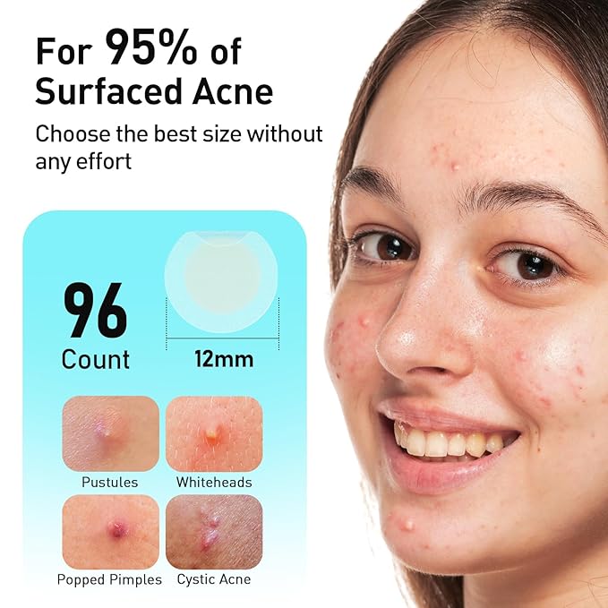 TKTK Pimple Patches, 12mm Invisible Acne Patches for Face with Salicylic Acid, 0.01cm Extra Thin Outer Edge, Hydrocolloid Zit Patch for Pustule, Whitehead, Cystic Acne Spot, 96 Count