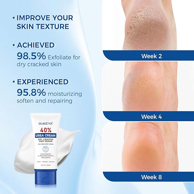 OUKEYA Urea Cream 40 Percent Tube, Urea Cream 40 Percent For Feet Maximum Strength, with Foot Callus Remover, Nano Glass Foot File
