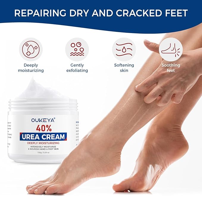 OUKEYA NEW FORMULA Urea Cream 40 Percent for Feet Maximum Strength, Hand Heels Dry Cracked Treatment Lotion for Knees & Elbows, Foot Dead Skin Cuticle Callus Remover Toenail Softener, 5.29 oz