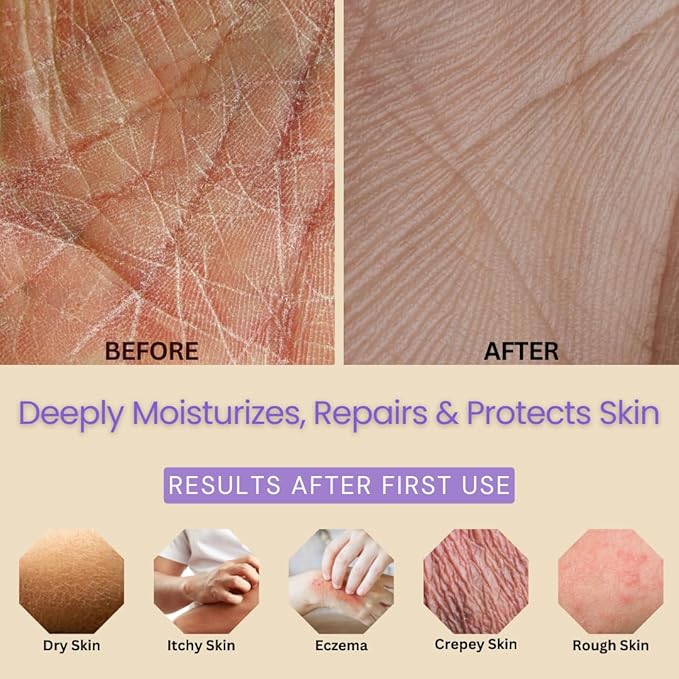 Lavender Body Lotion for Dry Sensitive Skin, Eczema Relief Moisturizer with Aloe Vera, Olive Oil, Ceramides, Vitamin B5 and E, Hand and Body Cream for Women and Men, 8oz