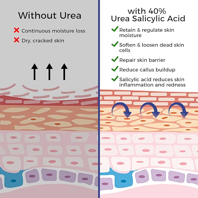 OUKEYA Urea Cream 42 Percent For Feet Plus 2% Salicylic Acid 5.29 oz, Foot Cream and Hand Cream Maximum Strength Intensive Repair Treatment, 3 Pack