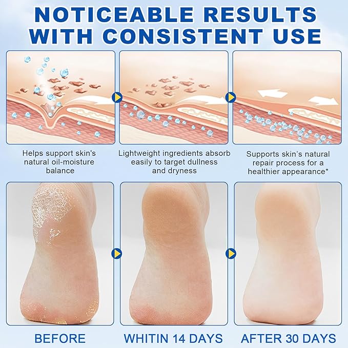 60% Urea with 2% Salicylic Acid Urea Foot Care Stick, Foot Cream 60 Percent for Feet Maximum Strength Moisturizer for Dry Cracked Heels, Hands, Thick & Cracked Skin, Callus Remover, Deep Hydration