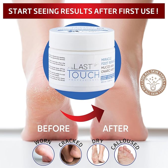 LAST TOUCH Miracle Cracked Repair Foot Care Cream - Foot Cream Dry Cracked Heels - Guaranteed Relief Worn, Cracked, Dry, Callused Feet - Athletes Foot Cream - Soft Smooth Feet 3.38 Fl Oz