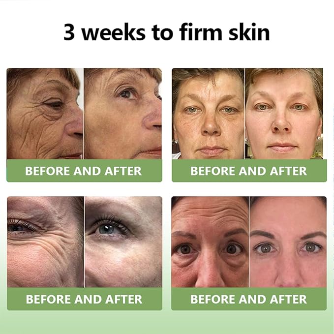 STDEI Luxurious Collagen Firming Cream，Advanced Firming Cream, Skin Tightening, Deep Moisturizing, For All Areas of the Body (1)