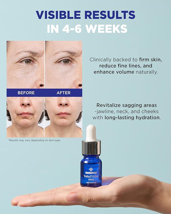 100% Volufiline Ampoules – Advanced Firming & Lifting Facial Ampoule from France Sederma, Intense Hydration & Skin Rejuvenation for Youthful, Perfect for Layering & DIY, 0.33 fl.oz (10ml) 3 Pack