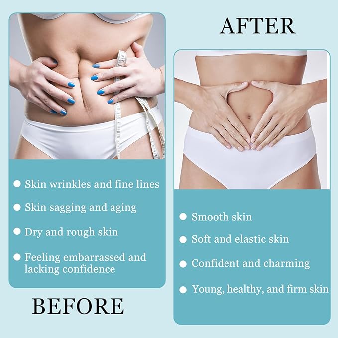 2PCS Luxelift Skin Firming Youth Butter,LuxeLift Skin Firming Body Butter,Luxelift Skin Firming Butter,Butter Anti Aging Moisturizer,Luxelift Skin Firming Cream for Body Loose Skin for Neck Arms Legs