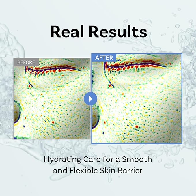 Exosome Squal-Tox Booster Cream Mist 3.38 fl oz (100ml) – Hydrating, Soothing, and Brightening with Squalane, Centella Asiatica, and Niacinamide