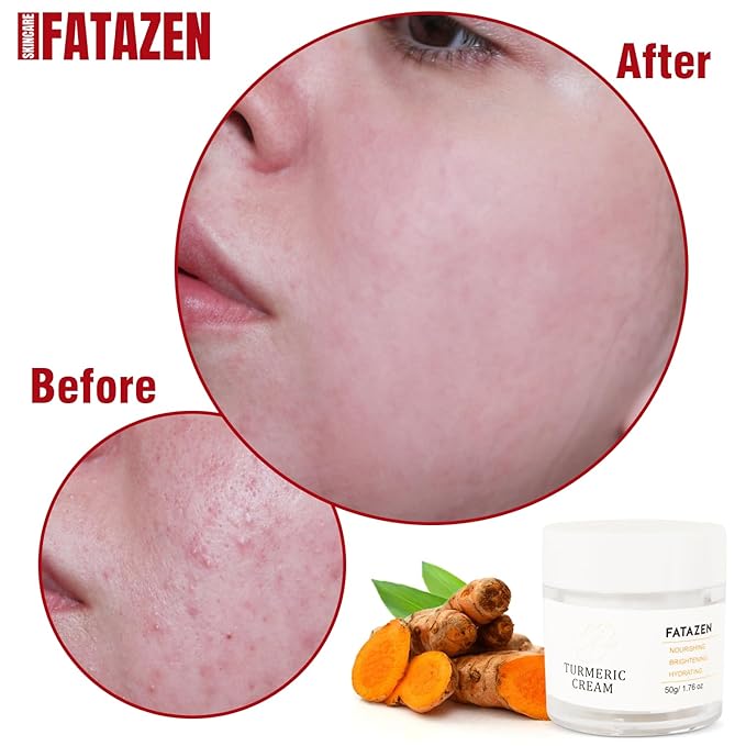 Turmeric Face Cream with Hyaluronic Acid & Aloe Vera for Acne-Prone Skin, Non-Comedogenic Daily Brightening Turmeric Moisturizer, Tea Tree Cream Calming Redness & Balancing Oily Sensitive Skin