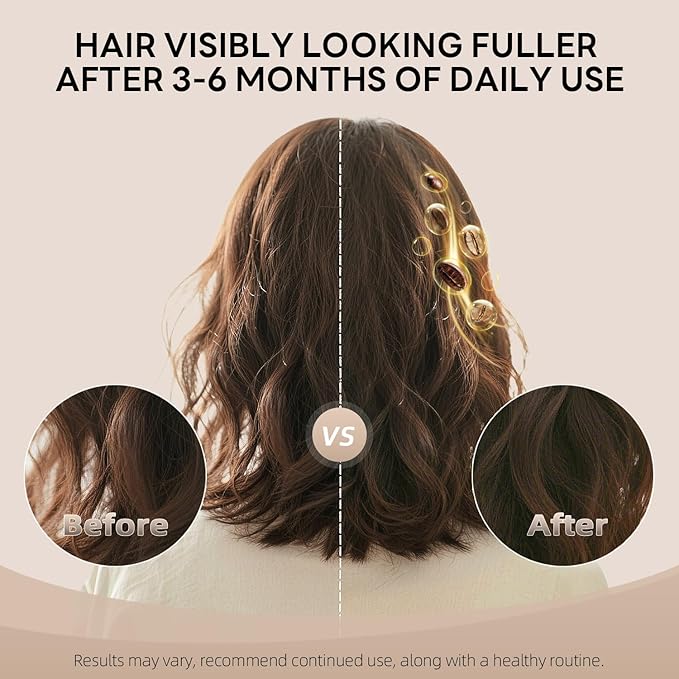 ALFHEIM Coffee+ Thickening Shampoo | Caffeine & Biotin for Hair Growth & Strength | Volumizing & Moisturizing for Fine, Thinning Hair | Sulfate-Free, Color-Safe Formula | 10.7 fl oz