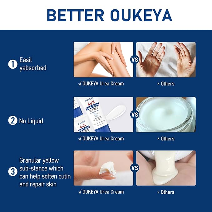 OUKEYA Urea Cream 40 Percent Tube 3 Oz, Urea Foot & Hand Cream for Dry Cracked, 40 per Urea Lotion for Feet Maximum Strength 3 Ounce(Pack of 3)