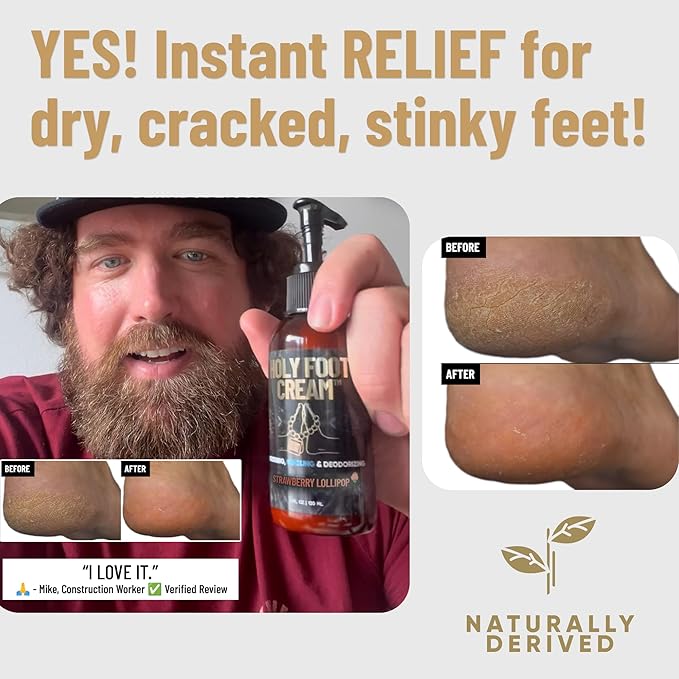 Derm Dude Foot Rescue Bundle | Coconut Rush Holy Foot Cream 4oz + Mint Scent Foot & Shoe Deodorizer Spray 2oz | Moisturizer for Dry Cracked Feet & Odor Control Spray with DeoPlex, Aloe, Tea Tree