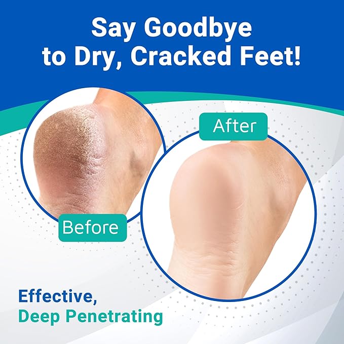 Dermal Therapy - Heel Care Cream, Foot Cream for Dry Cracked Heels, Intense Foot Moisturizer with Urea and AHA, Foot Lotion with Non-Greasy Formula, 300g