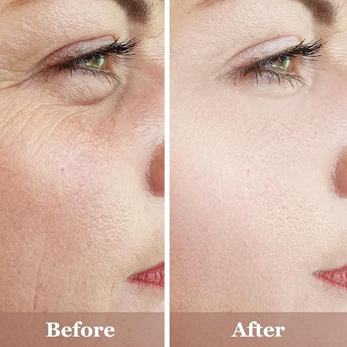 Mivida Anti-Aging Serum Trio| 20% Vitamin C + Hyaluronic Acid + 2.5% Retinol Serums For Face | Brightening, Firming & Hydrating Skincare Set | Reduces Wrinkles, Fine Lines & Dark Spots, 3x1floz