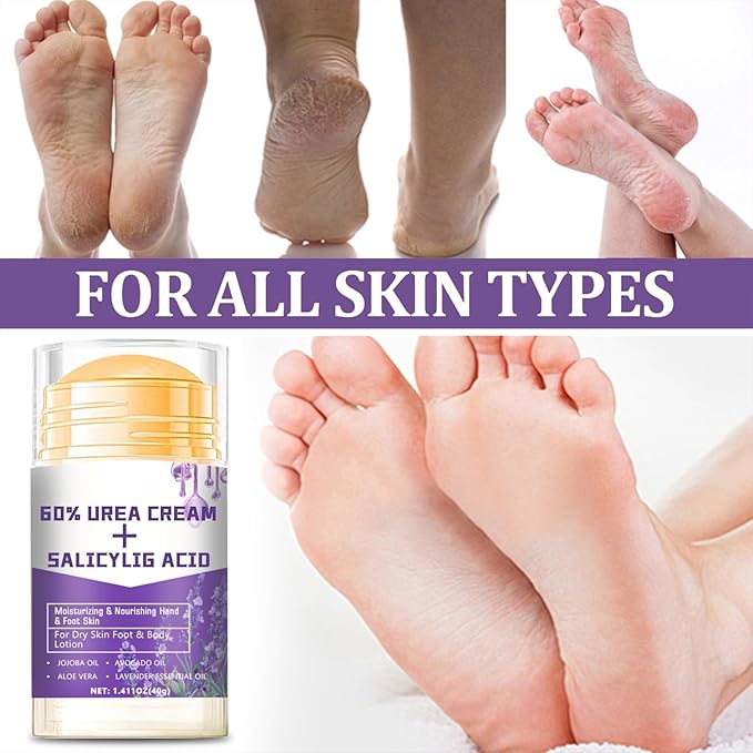60% Urea Cream - 1.41 oz Lavender Foot Hand Cream Stick for Dry & Cracked Feet Elbows Knees Heels Hands, Hydrates & Nourish Foot Care for Softening and Moisturizing, Removing Calloused Skin