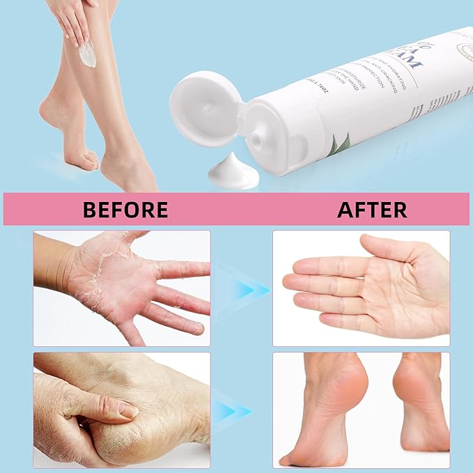 Urea Cream 40 Percent for Feet Maximum Strength, Urea Foot and Hand Cream with Powerful Hydration for Dry Skin, Cracked Heels, Deeply Moisturizing for All Skin Types 1.76oz
