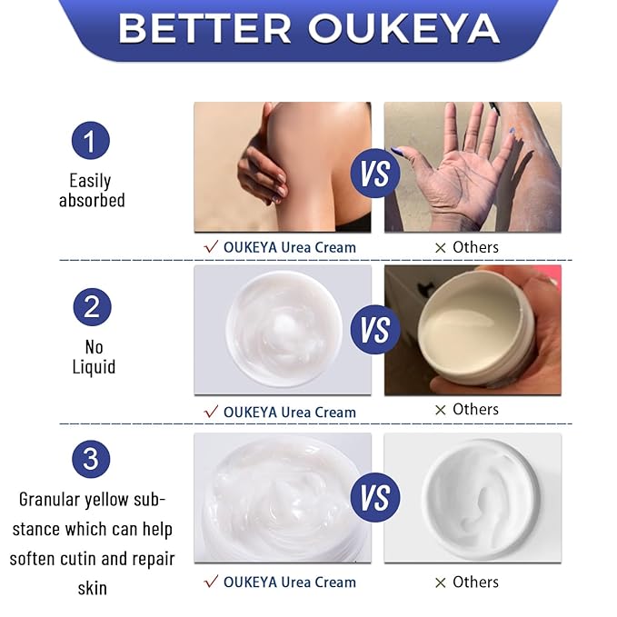 OUKEYA Urea Cream 42 Percent For Feet Plus 2% Salicylic Acid 5.29 oz, Foot Cream and Hand Cream Maximum Strength Intensive Repair Treatment, 3 Pack