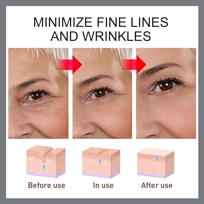 Advanced Retinol Moisturizer, Anti-Aging Cream with Hyaluronic Acid, Vitamin E, Green Tea & Jojoba Oil for Wrinkles, Hydrating and Improving Skin Elasticity - All Skin Type -1.7 Oz