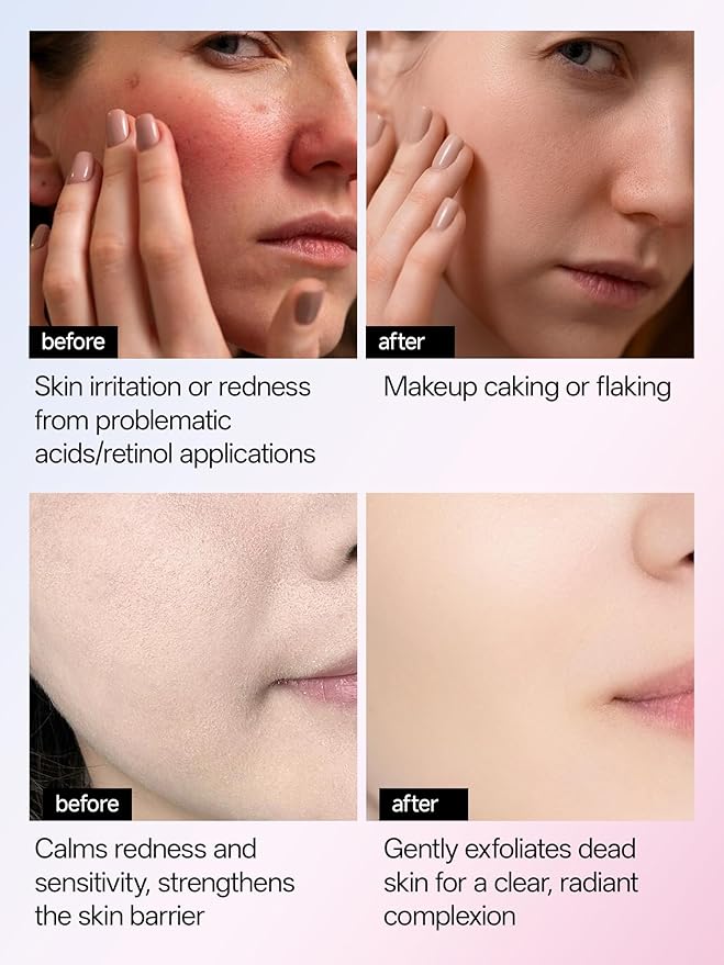 WNP 6D Bionic Collagen Bio‑Gel Mask Hydrating Overnight Real Deep with 5.1% Collagen, Niacinamide, Hyaluronic Acid|Firming, Anti‑Aging, Brightening for sensitive skin 28g x4ea