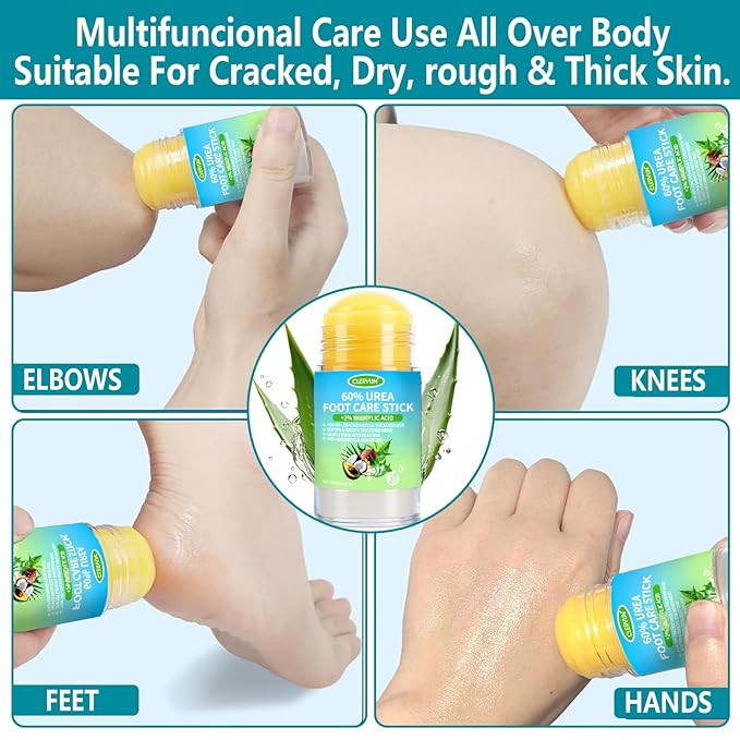 60% Urea Cream Stick with 2% Salicylic Acid, Anti-Cracking Foot & Hand Cream Moisturizer for Dry Cracked Heel Feet, Knee, Elbow, Foot Balm Stick for Callus Remover & Dead Skin Softener (1)