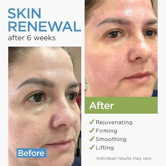 Collagen Face Cream with Stem Cells Retinol Hyaluronic Acid Niacinamide for All Skin Types - Anti-Aging Face Moisturizer with Airless Pump - Day & Night Cream for Wrinkles - Made in USA 1.7 Oz