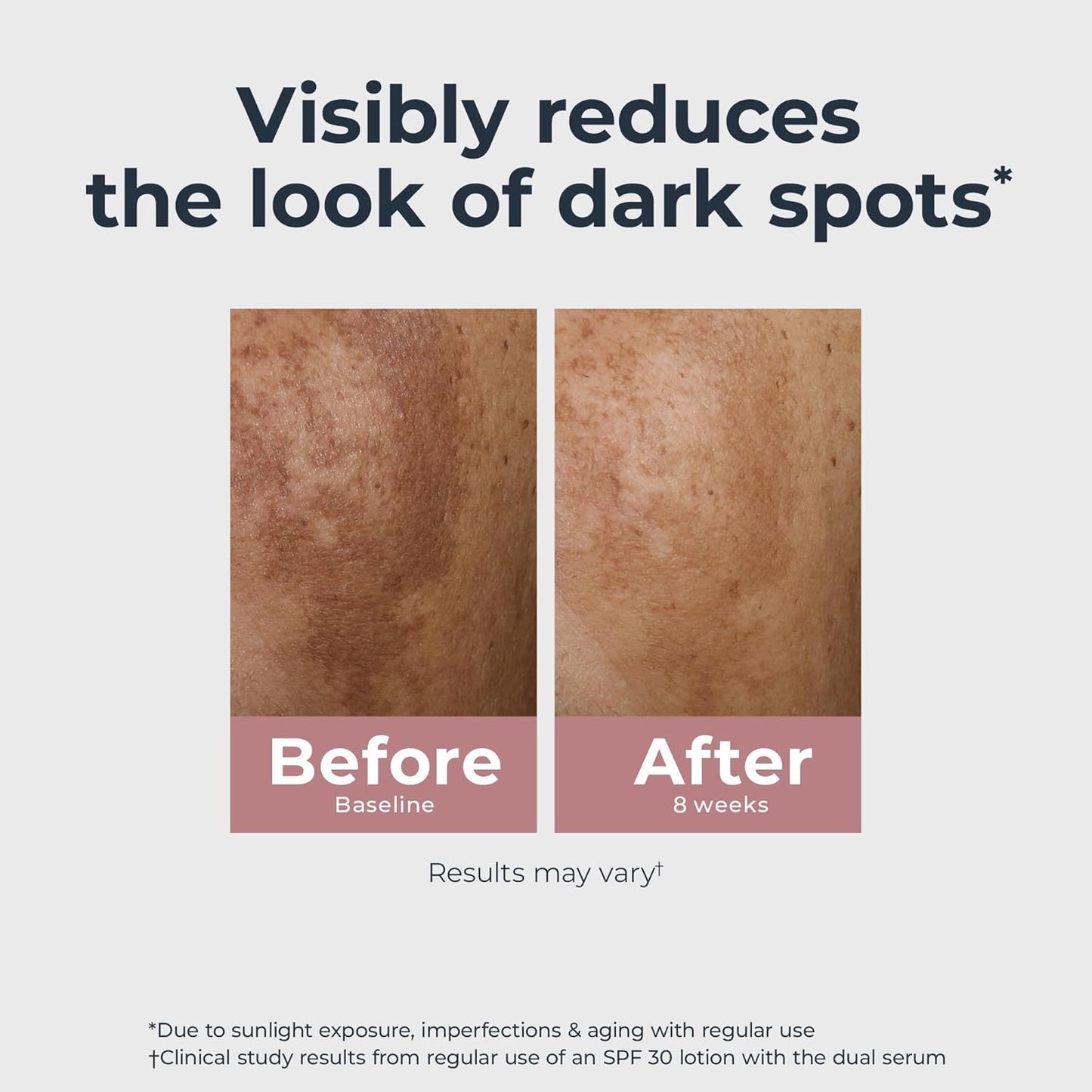 Radiant Tone Dual Serum – Dark Spot Corrector, 1 oz ✨🌿