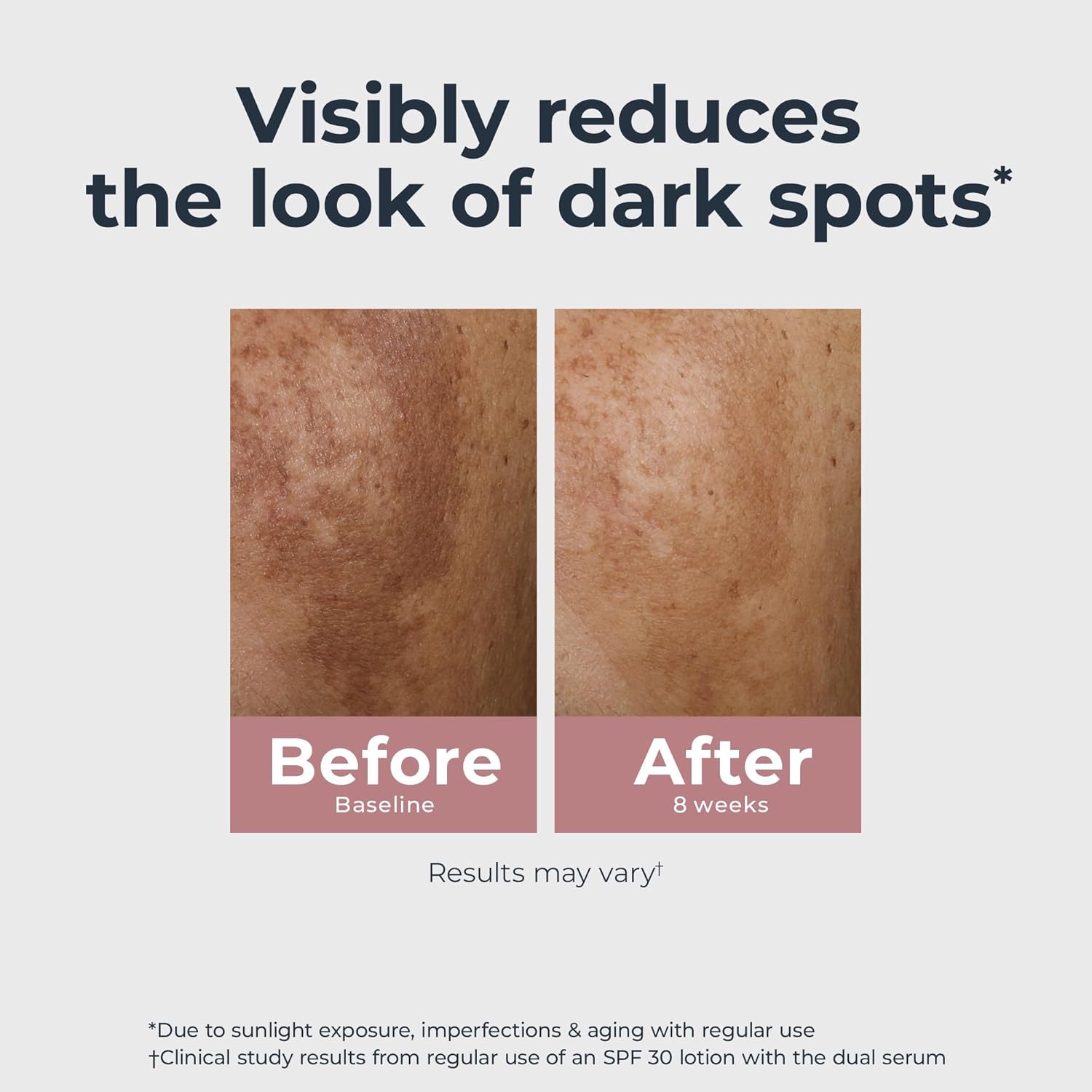 Radiant Tone Dual Serum – Dark Spot Corrector, 1 oz ✨🌿