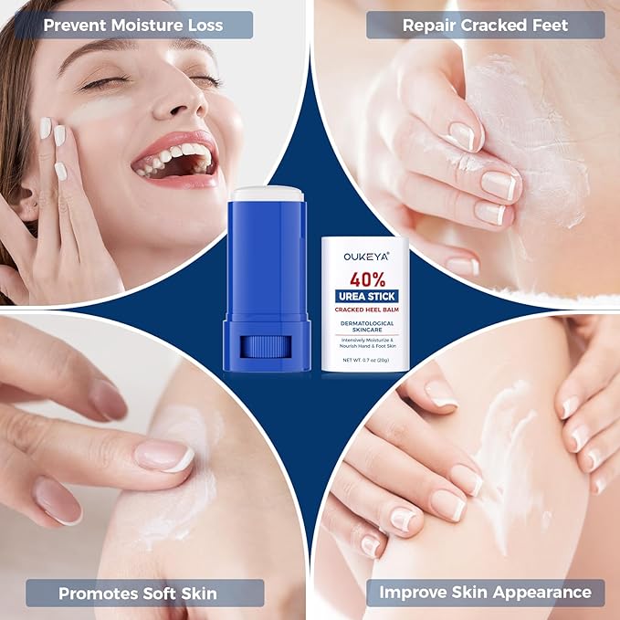 OUKEYA Urea Cream 40 Percent.Urea Cream Stick for Foot and Hand Cream Stick for Dry Cracked, Cracked Heel, Avoid Frostbite, 40 Percent Urea Lotion for Feet Maximum Strength, 2 PACK