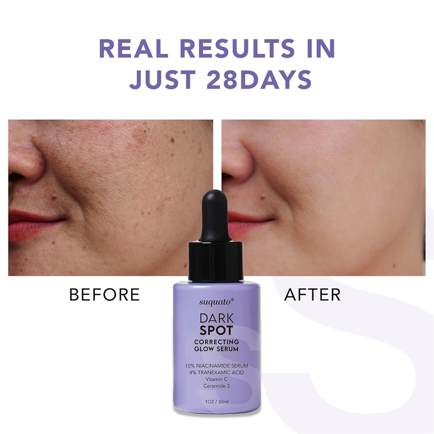 ✨ Dark Spot Correcting Glow Serum – Tranexamic Acid & Vitamin C