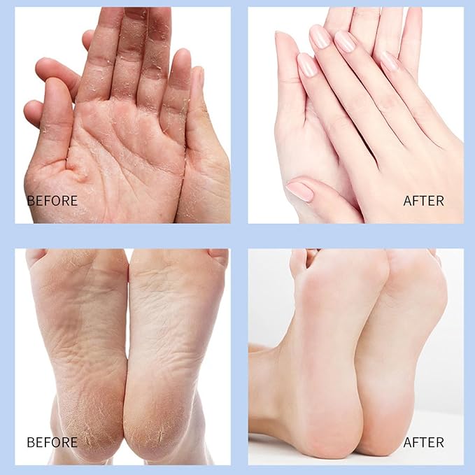 Crack Feet Prevention Stick, Anti Crack Foot Cream Stick, Foot Care Cream Cracked Feet, Moisturizing Foot Balm, Softening and Nourishing Cream for For Dry Heels