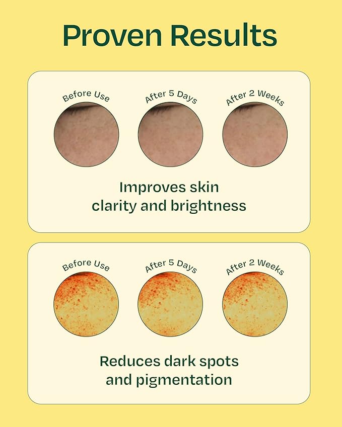 YADAH Green Tangerine Vita Serum 1.01 Fl oz 1-Pack - Hydrating, Revitalizing Serum with Vitamin C for Dull Skin and Radiant Complexion