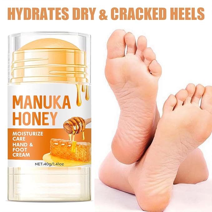 60% Urea Cream - Manuka Honey Foot Hand Cream Stick for Dry & Cracked Feet Elbows Knees Heels Hands, Hydrates & Nourish Foot Care for Softening and Moisturizing, Removing Calloused Skin