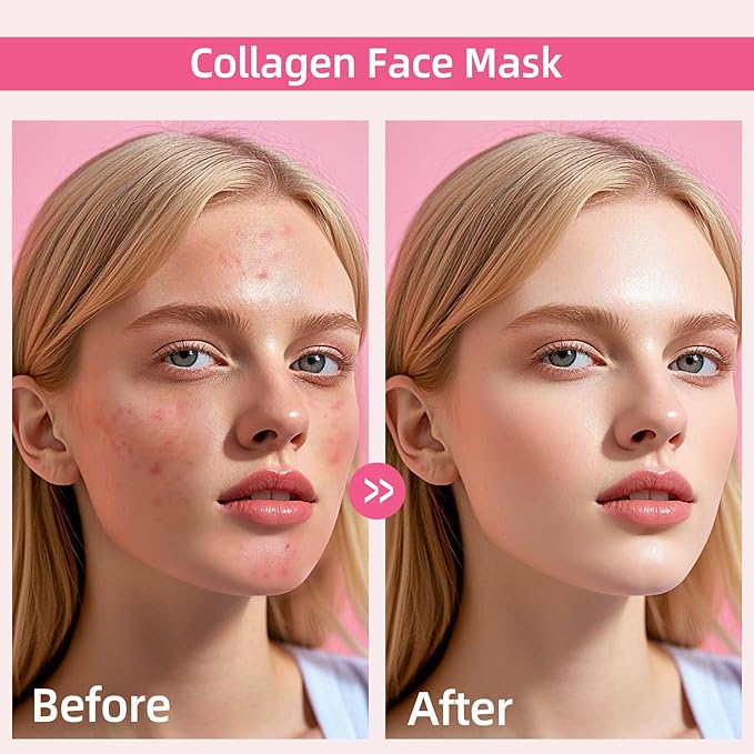 Collagen Face Mask: Deep Collagen Overnight Mask, Anti Aging Lifting Mask, Hydrating Face Mask for All Skin Types, Pore Minimizing, Elasticity Skin, 5 Pack