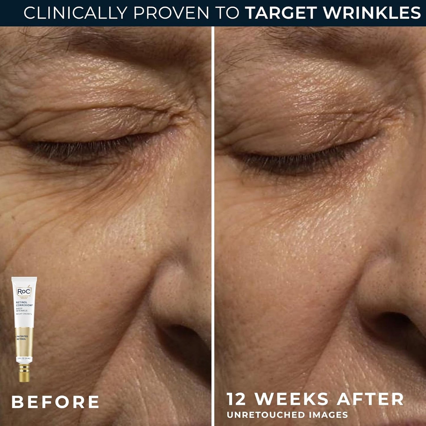 Retinol Correxion Anti-Aging Skincare Duo – Deep Wrinkle Night Face Cream + Under Eye Cream for Dark Circles & Puffiness | Retinol Value Set for Mature Skin (Packaging May Vary)