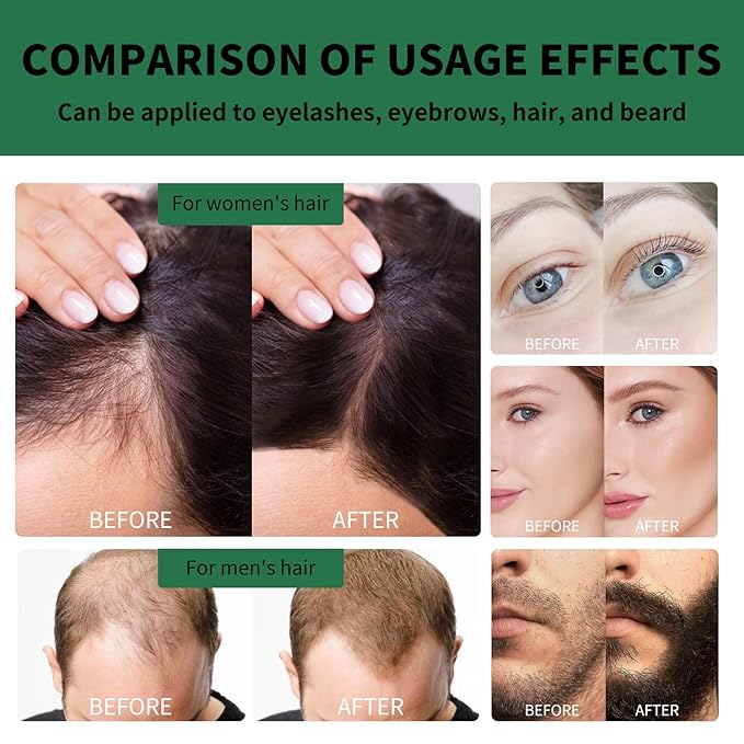 Jamaican Black Castor Oil for Hair Growth, Castor Oil Cold Pressed with Biotin for All Hair Styles 2 Fl Oz/pcs