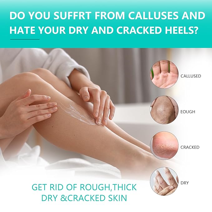 2 Packs Urea Cream 40 Percent for Feet Maximum Strength, Urea Foot and Hand Cream with Powerful Hydration for Dry Skin, Cracked Heels, Deeply Moisturizing for All Skin Types 7.05oz