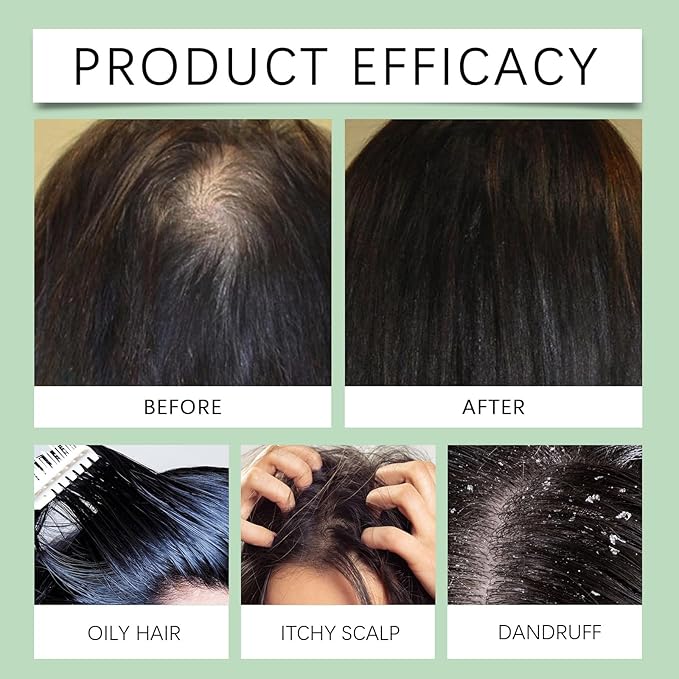 Scalp Scrub with Massaging Brush - 100g Sea Salt Exfoliator Infused with Rosemary & Peppermint Oil for Deep Cleansing, Hydrating Scalp Care Treatment