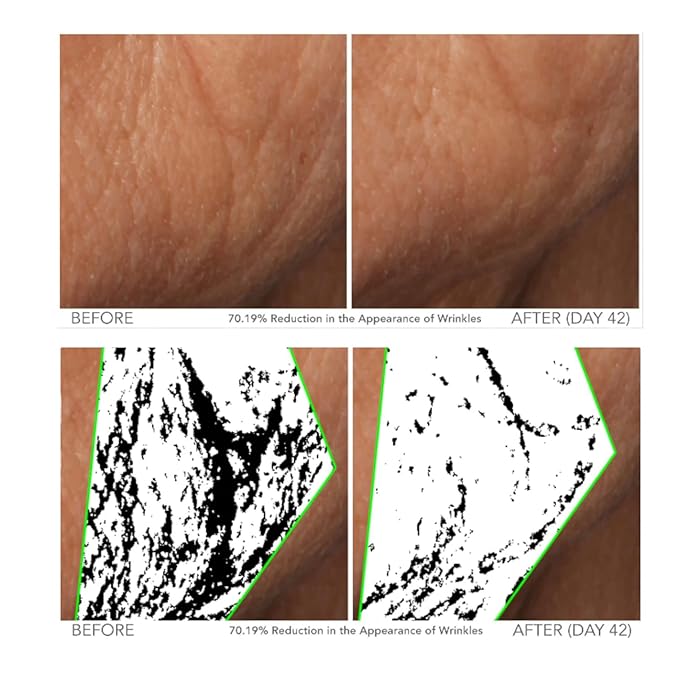 Serious Skincare - Beyond Intensive Vitamin C Serum for Face - 60 Day Facial Treatment for Healthy Glowing Skin and Brightening - Smoothes Lines, Pores and Fades Dark Spots - 2 Piece Anti-Aging Set