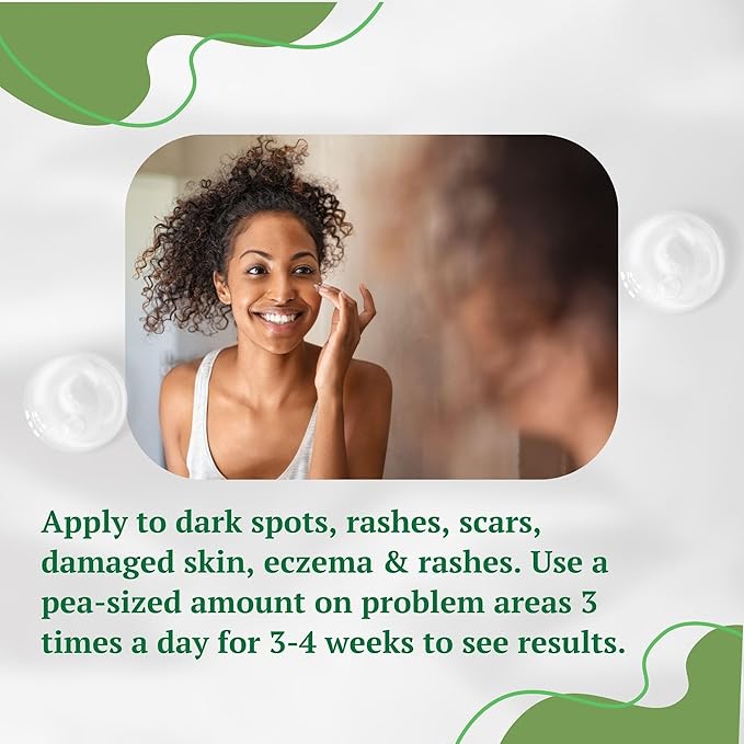 Aloe Vera Cream, Correct Dark Marks, Dry Skin and New Scars on Body, Face Cream for Blemishes, Reduce Appearance of Scars from Acne, Dark Spot Remover For Men, Women and Kid