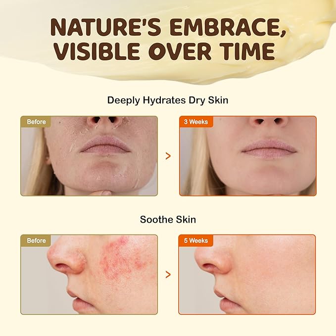 Vigority Beef Tallow and Honey Balm: Organic Grass Fed Whipped Beef Tallow for Skin - Beef Tallow Face Moisturizer Infused with Manuka Honey, Beeswax and Olive Oil - 2 oz, Unscented