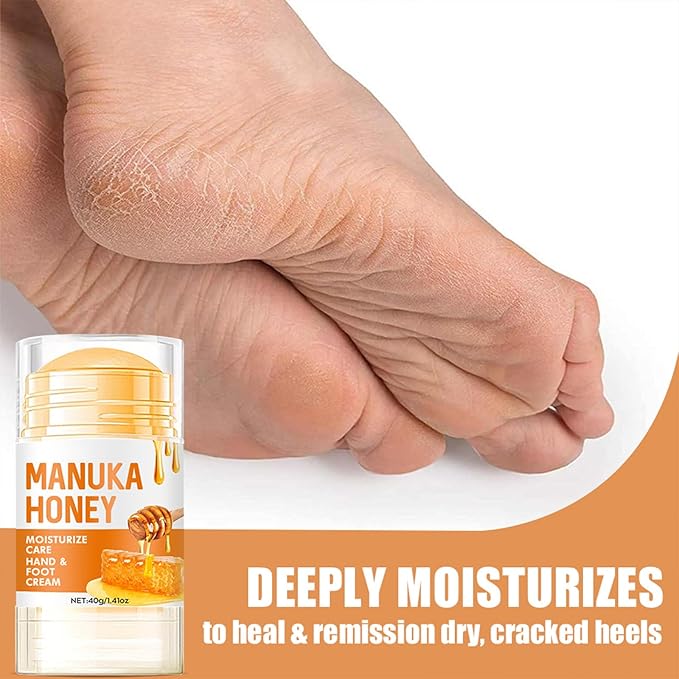 60% Urea Cream - Manuka Honey Foot Hand Cream Stick for Dry & Cracked Feet Elbows Knees Heels Hands, Hydrates & Nourish Foot Care for Softening and Moisturizing, Removing Calloused Skin