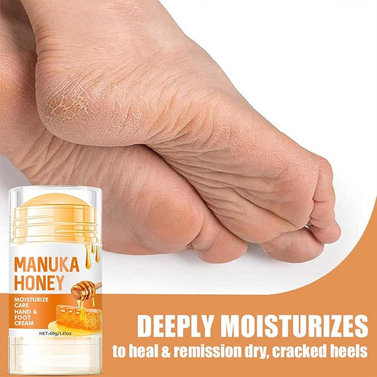 60% Urea Cream - Manuka Honey Foot Hand Cream Stick for Dry & Cracked Feet Elbows Knees Heels Hands, Hydrates & Nourish Foot Care for Softening and Moisturizing, Removing Calloused Skin