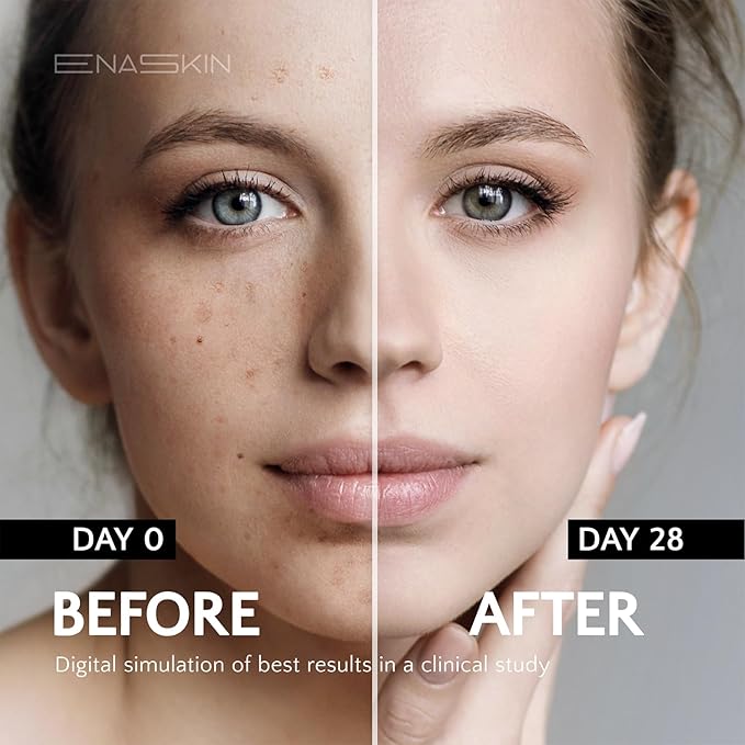 EnaSkin Dark Spot Remover Face & Body Serum: Age Spot Sun Spot Freckles Melasma Brown Spot - Advanced Formula with Niacinamide for Women and Men (1.0 Fl Oz)