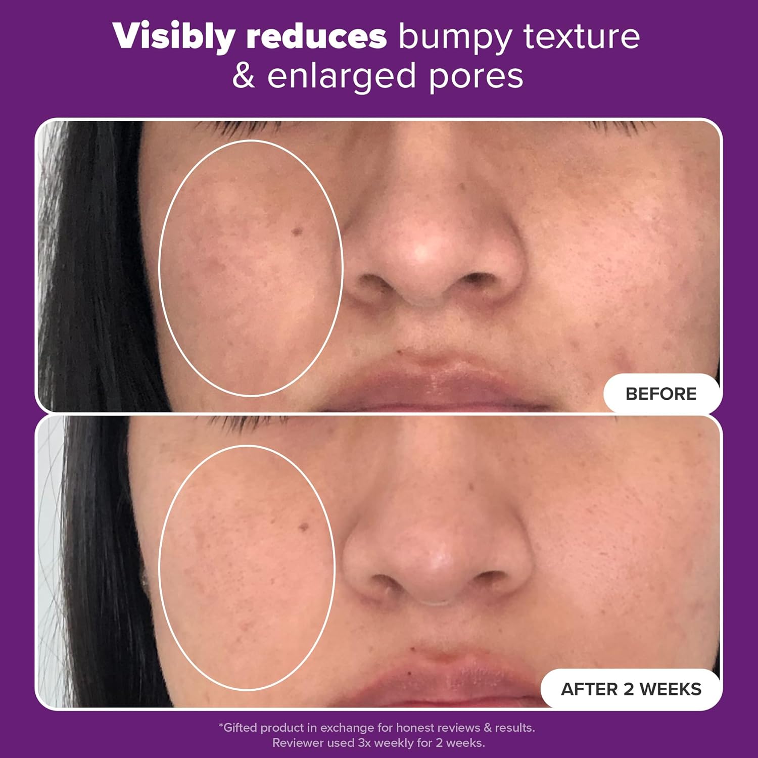 CLINICAL 20% Niacinamide Serum – High Strength Vitamin B3 Face Serum for Anti-Aging, Dark Spots & Enlarged Pores | Fragrance-Free Skin Brightening Treatment | 0.67 Fl Oz