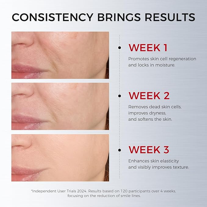 Smile Line & Under Eye Patches – 4-Peptide Anti-Wrinkle Treatment with Collagen, Caffeine & Niacinamide – Firming, Hydrating, Brightening Face Pads for Laugh Lines, Eye Bags, 10 Pairs