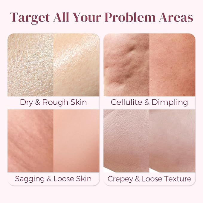 Cellulite Cream Booty Tight Lift and Firm - Smooth & Sculpt Booty, Thighs, Belly & Arms | LIFTONIN® Skin Firming & Toning Bum Mask 3.72 fl oz