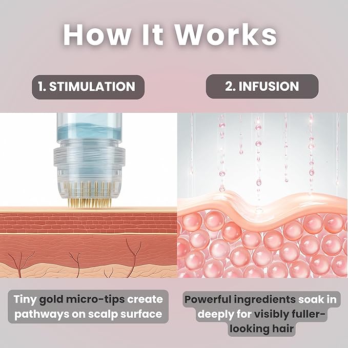 Glov Beauty Micro Infusion Hair Renewal Kit – 0.25mm Gold Derma Stamp with Hyaluronic Acid, Peptide & Botanical Serum Ampoules | Hydrating Scalp Treatment for Fuller, Thicker-Looking, Healthier Hair