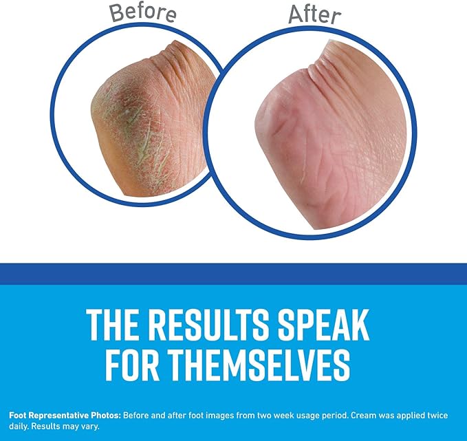 O'Keeffe's K0280004-8 Healthy Feet Foot Cream Tube (8 Pack), 3 oz