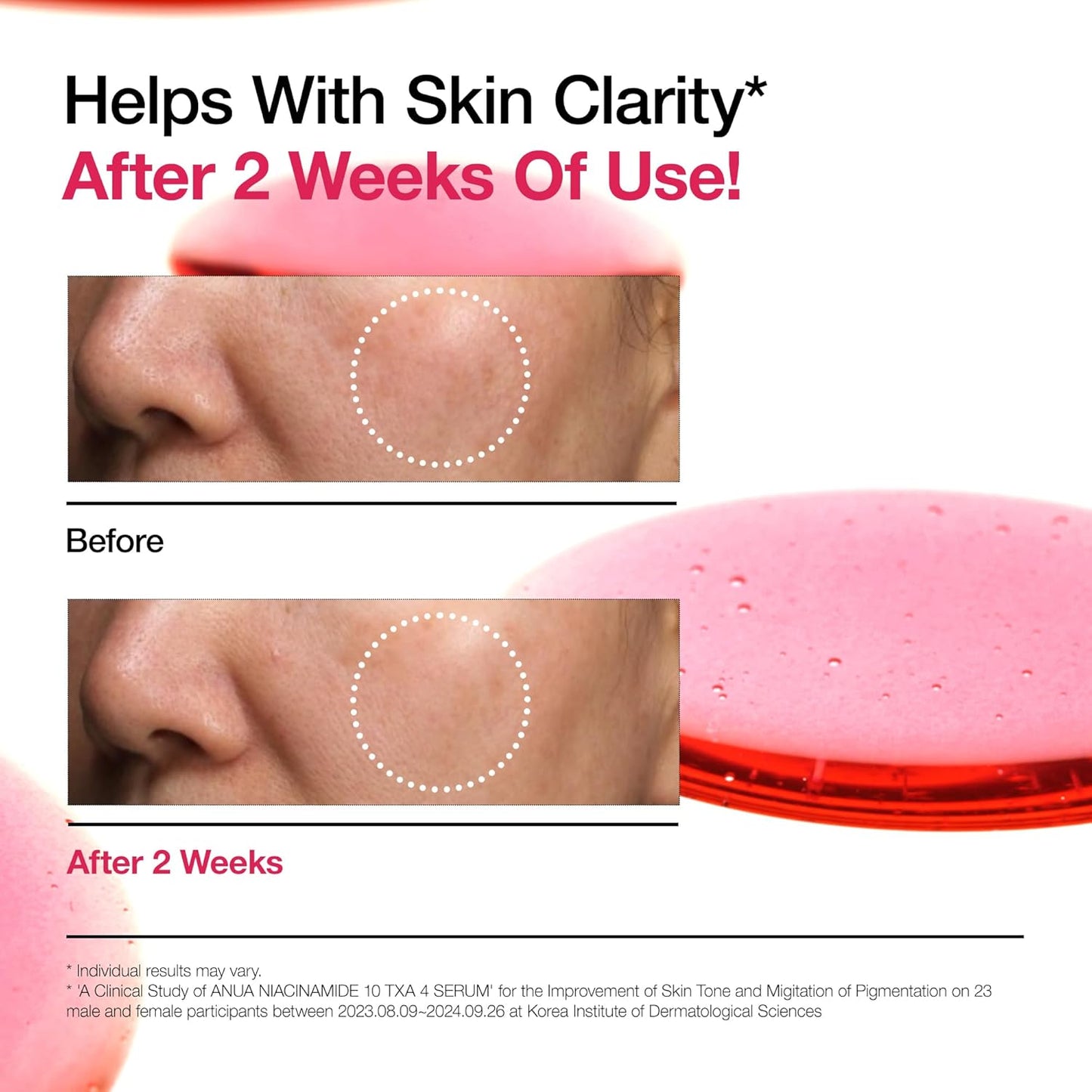 Niacinamide 10% + Tranexamic Acid 4% Serum with Hyaluronic Acid & Vitamin B12 – Brightening Korean Facial Serum for Glass Skin, Dullness, and Uneven Tone – 30ml Radiance Booster