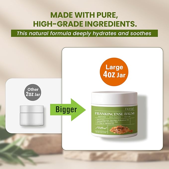 Dersie Frankincense Balm - 4 oz | Soothes Muscles & Joints, Supports Skin Renewal & Nourishment – All Natural Balm for Muscle, Joint & Foot Discomfort and Dry Skin, Infused with Frankincense Oil